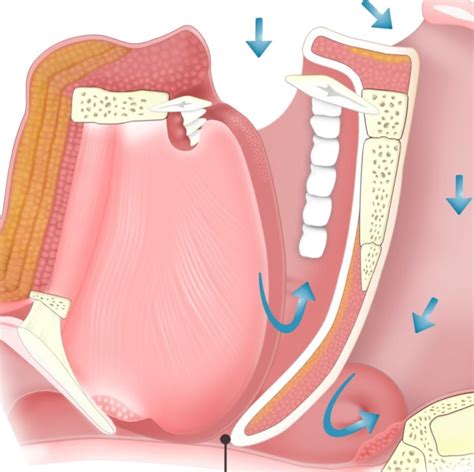 Diagnosing OSA With Airway, Nonairway Parameters Identified With Ultrasound - Pulmonology Advisor