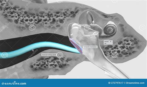 The Tympanic Membrane (eardrum) Separates the External and Middle ...