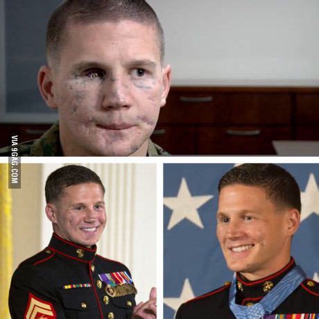 Medal Of Honor recipient Kyle Carpenter before and after facial ...