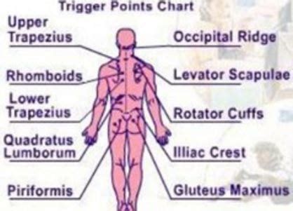 Trigger Point Injections - Side Effects, Complications, Procedure