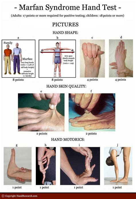 Pin on Genetics/epigenetics