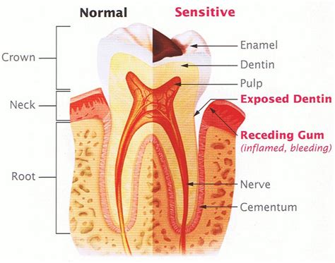 Sensitive Teeth? We Can Help - New Millennium Dental