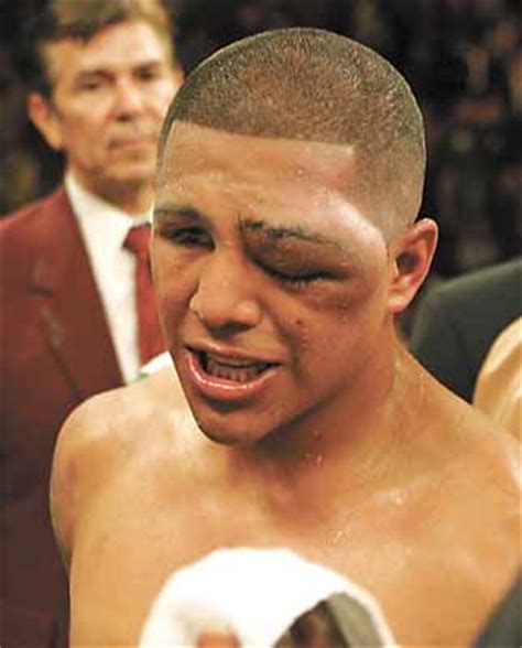 Antonio Margarito and the 15 Most Brutal-Looking Post-Fight Faces | News, Scores, Highlights ...