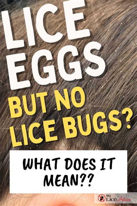 Lice Eggs But No Lice Bugs | Lice eggs, Lice bugs, Louse