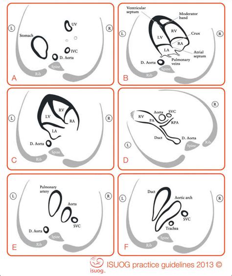 Guidelines for the Performance of the Sonographic Screening and Echocardiography Examination of ...