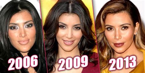 Mystery Of The 'Dramatic' Change In Kim Kardashian's Face: She Insists She's NEVER Had A Nose ...