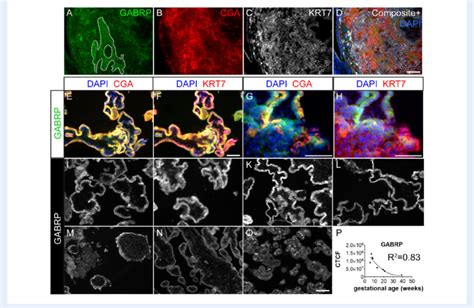 GABRP expression in human placenta samples over gestation. (A-D) Human... | Download Scientific ...