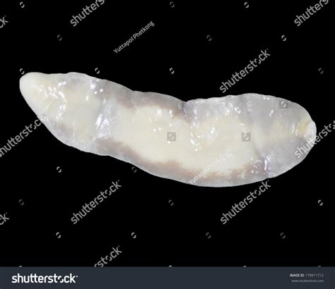 Fasciolopsis Buski Stock Photo 179911712 - Shutterstock