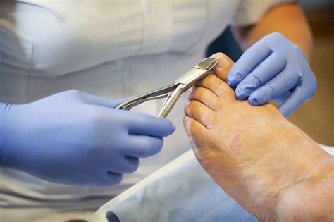 Chiropody — Happy Feet Podiatry Services | Belfast