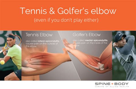 Tennis & Golfer's elbow (even if you don't play either) - Spine and Body