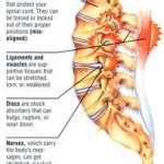 Dr. Lumbago – Lower back pain helpful information; sciatica and neck pain too - Dr Lumbago