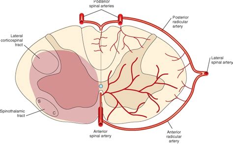 Anterior spinal artery syndrome | Medicine Specifics