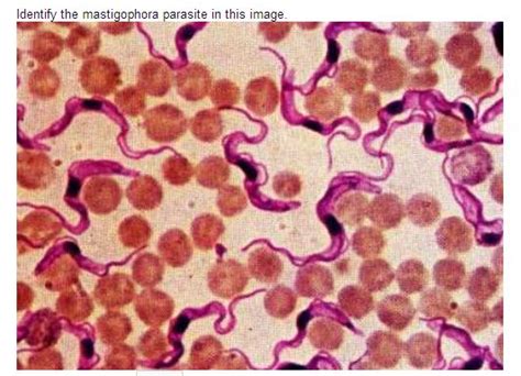 Solved: Identify The Mastigophora Parasite In This Image. | Chegg.com