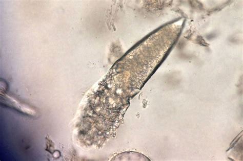 Demodex Mites Meet The Microscopic Parasites That Crawl Around Your | My XXX Hot Girl