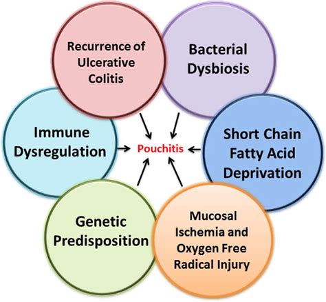 Pouchitis, Chronic Pouchitis - Causes, Symptoms, Treatment