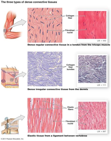 dense irregular connective tissue labeled - Google Search | Medical anatomy, Tissue types ...