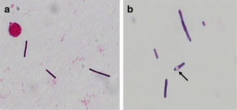 Gram Stain Morphology Of Clostridium Septicum From Csf A | My XXX Hot Girl