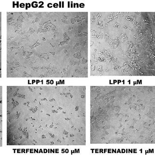 These photos show the microscopic image of HepG2 cell line morphology ...