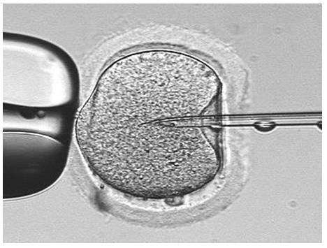 Fact Sheets about Microinjection — the Definition, Types, Advantages and Applications | by ...