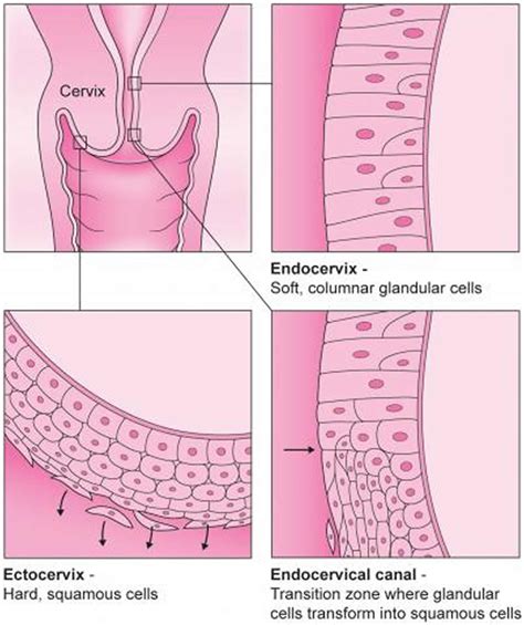 Colposcopy - Colposcopy Biopsy, Results, HPV, Side Effects