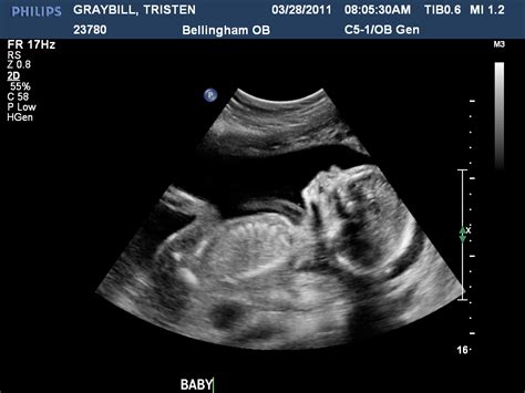 Inside Tristen: 20 Week Ultrasound: ITS A BOY!!