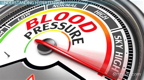 What Is Hypertension (HTN)? - Definition, Symptoms & Causes - Video & Lesson Transcript | Study.com