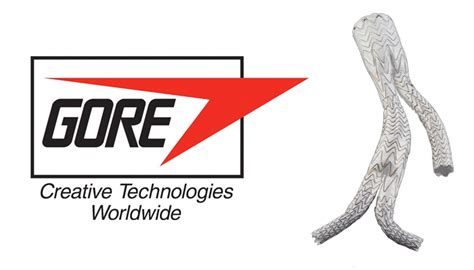 Gore wins Health Canada approval for Excluder stent graft - MassDevice