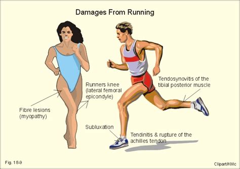 Sporty Foot: 8 Common Running Injuries