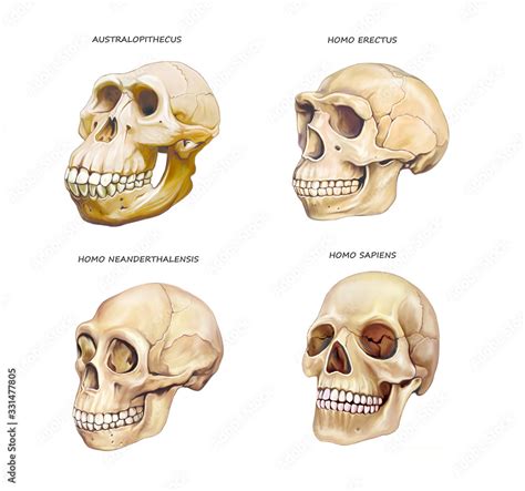 Types Of Human Skulls