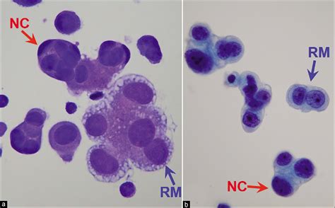 The panorama of different faces of mesothelial cells - CytoJournal