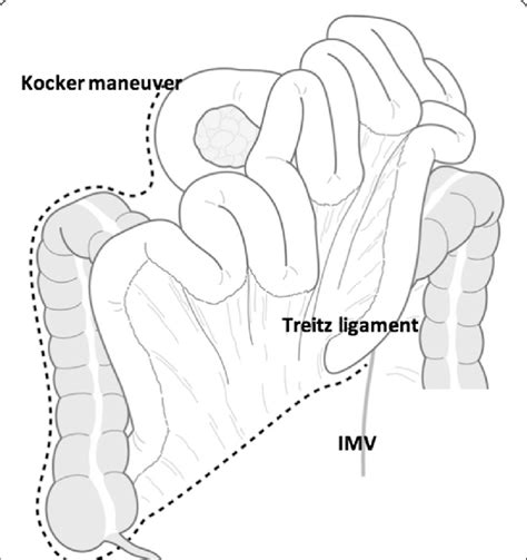 The Cattell Braasch maneuver consists of mobilization of the right... | Download Scientific Diagram