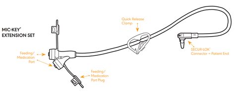 MIC-KEY Low Profile Gastrostomy Feeding Tube Kit - 12, 14, 16, 18, 20 ...