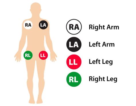 12-Lead ECG Placement Guide with Illustrations | Patient care technician, Ecg nursing, Nursing ...