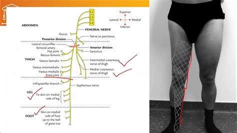 femoral and obturator nerve injury - YouTube