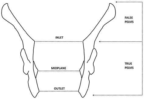 True And False Pelvis - slidesharetrick