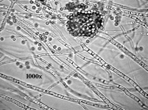 xanthocomically: An Introduction to Fungi The first thing to… – Roberts Lab