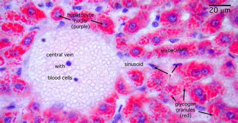 17 Best images about Histology - Liver on Pinterest | Medicine, Portal ...