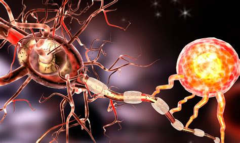 How Does Primary Progressive Multiple Sclerosis Differ From Other Diagnoses? - WorthvieW