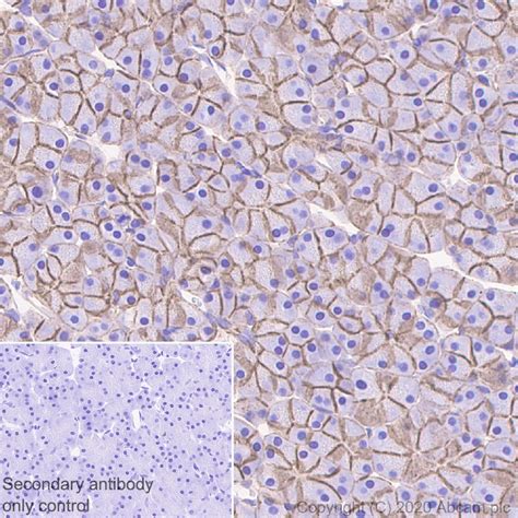 Anti-beta Catenin antibody KO Tested (ab16051) | Abcam