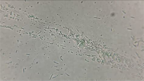 Dental plaque under a microscope - YouTube