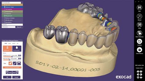 نرم افزار طراحی اگزوکد Cad Cam, E Type, Dental, Software, Teeth ...