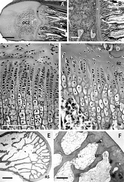 Histological aspect of the epiphyses. (A) General view of the epiphysis... | Download Scientific ...