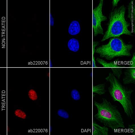 Alexa Fluor® 594 Anti-BrdU antibody [BU1/75 (ICR1)] (ab220076) | Abcam