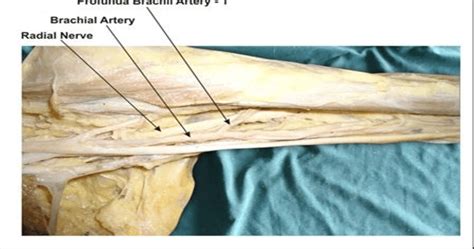 showing photographic presentation of the profunda brachii artery -1 ...