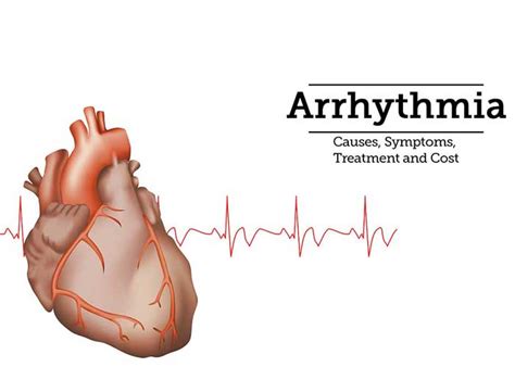 Best Diagnosis, and Treatment of Arrhythmias In Hyderabad