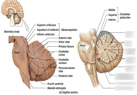 Flocculonodular Lobe Diagram