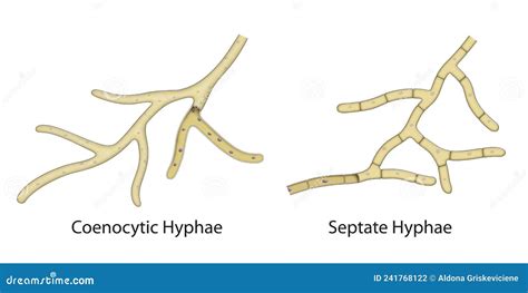 Fungal Cell Structure. Fungi Hyphae With Septa Vector Illustration ...