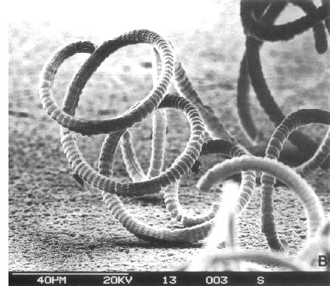 Morphology of Spirulina (Arthrospira) , Scanning electron micrograph of ...