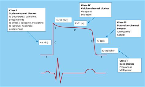 Classification and choice of antiarrhythmic therapies - Barton - 2020 ...