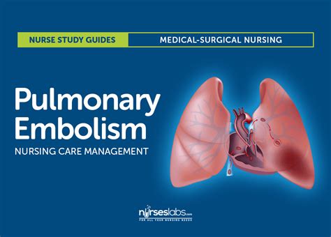 Pulmonary Embolism Nursing Care and Management: Study Guide